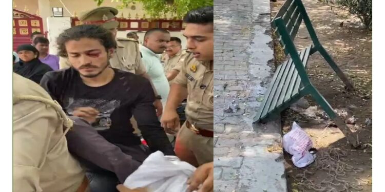 Lucknow: पार्क में सुतली बम बनाते समय विस्फोट, युवक का पैर फटा, दोस्त के साथ बना रहा था बम