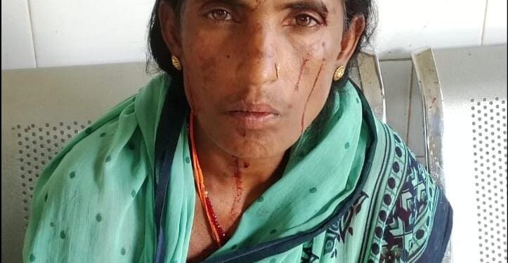 मारपीट व जान से मारने का मामला कोंरधा थाना चौकी दर्ज..
