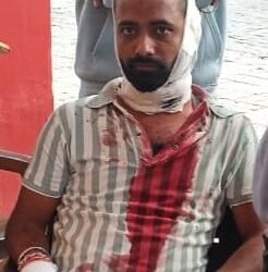 कबाब पराठे के पैसो के लेनदेन को लेकर ग्राहक की पिटाई कर रेता गला हालत गंभीर