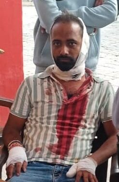 कबाब पराठे के पैसो के लेनदेन को लेकर ग्राहक की पिटाई कर रेता गला हालत गंभीर