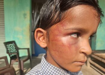 बलरामपुर: प्राथमिक स्कूल में शिक्षक द्वारा दूसरी कक्षा के छात्र की बेरहमी से पिटाई, आंख में उतरा खून; प्रधान पाठक निलंबित..