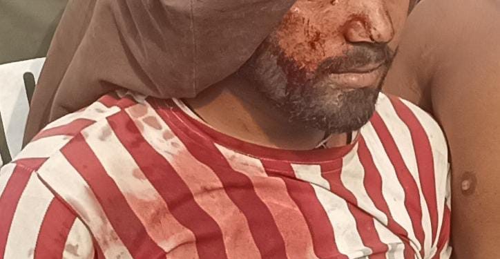 बाइक डिवाइडर से टकराई, दो युवक घायल 